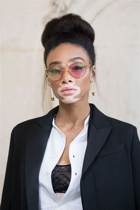 Winnie Harlow Asks Do You See Me Suffering Foxy 1071 1043