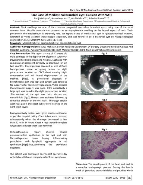 Pdf Rare Case Of Mediastinal Branchial Cyst Excision With Vats