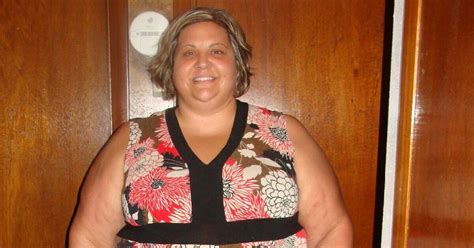 Obese Mum Who Lost 13 Stone Through Therapy Plans Five Operations To Remove Two Stone Of Baggy