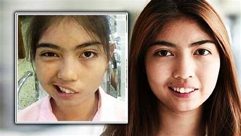 Thai Schoolgirl Learns To Smile Again After Teacher Assault Free Malaysia Today Fmt