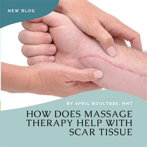 How To Massage Scar Tissue To Break It Down A Step By Step Guide