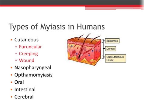 Myiasis In Humans Causes Symptoms Diagnosis Treatment