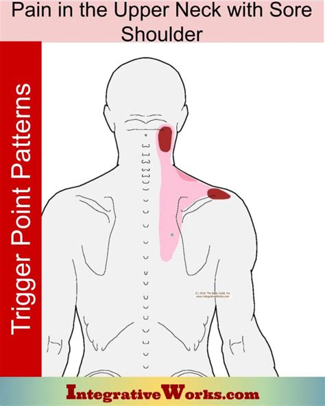 Upper Neck Pain With Sore Top Of Shoulder Integrative Works