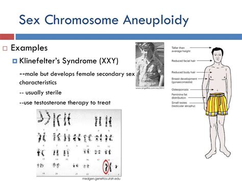 Xo Chromosome