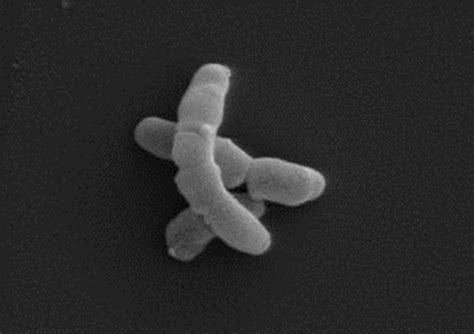 Anatomi Kehidupan Propionibacterium Acnes Bakteri Penyebab Jerawat