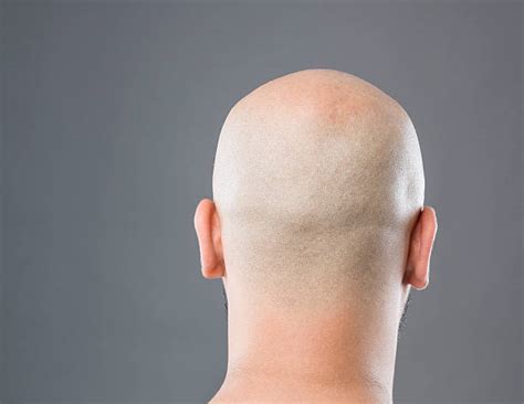 Bald Head Pictures Images And Stock Photos Istock