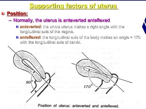 Retroverted Retroflexed Uterus Anduterine Inversion