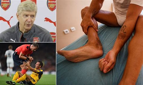 A sprained ankle is the most common injury for male soccer players and accounts for 17% of all injuries in both games and practices, according to the study. Arsene Wenger: Cazorla injury 'worst I have ever known ...