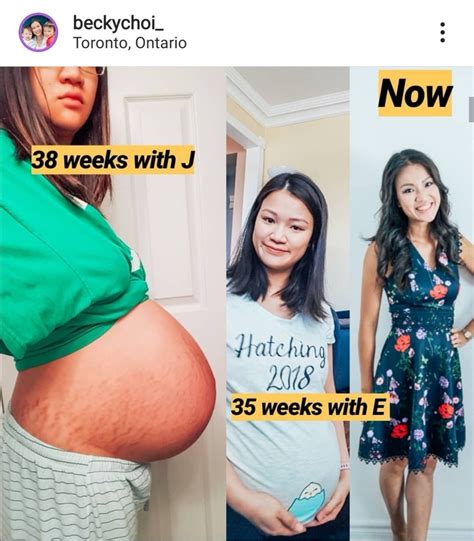 How to reduce swelling in the uterus during pregnancy? How to get rid of that postpartum belly when my tummy was ...