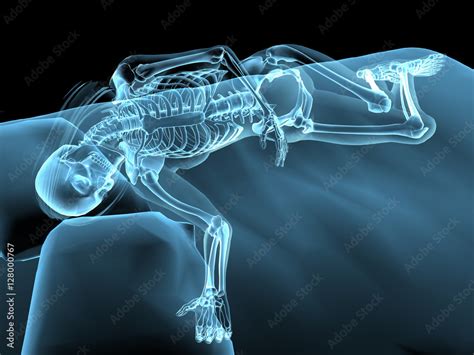 Blue X Ray Nude Sleeping Woman And Skeleton Stock Illustration Adobe