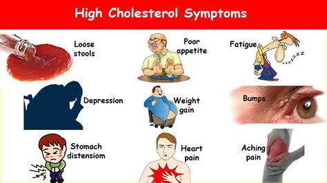 9 High Cholesterol Symptoms What Are High Cholesterol Signs And Symptoms