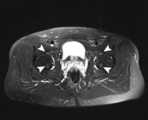Respiratory motion (the most frequent source for motion artifacts). Medical Apparatus Imaging Protocols: MRI