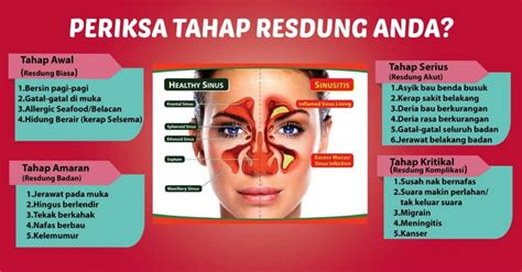 16 penyebab hidung berdarah pada orang dewasa yang harus diwaspadai sebab bisa jadi gejala hidung berdarah sering disebut mimisan. Ubat Rawat Hidung Tersumbat - Contoh Gaes