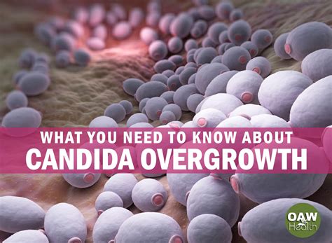 What You Need To Know About Candida Overgrowth