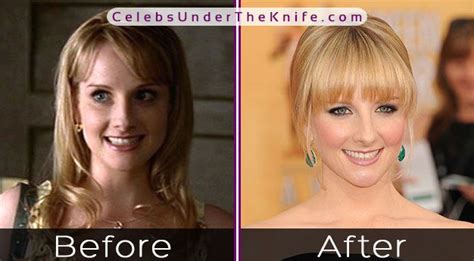 Melissa Rauch Before And After Xxgasm The Best Porn Website