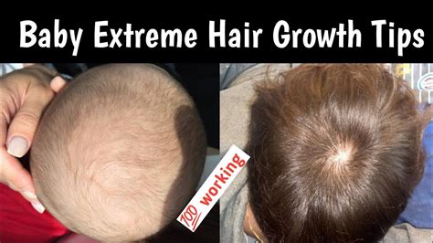 How To Grow Baby Hair Faster Baby Extreme Hair Growth Tips Babies