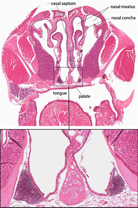 Figure 3 From Mucosal Vaccination By The Intranasal Route Nose
