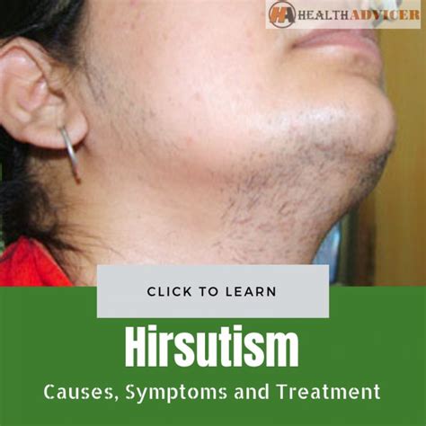 Hirsutism Causes Picture Symptoms And Treatment