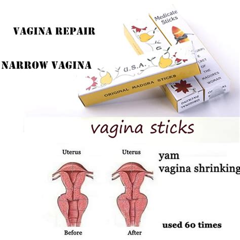 Vagina Tightening Sticks Telegraph