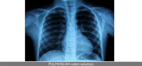 Production line ndt x ray systems. PULMOSCAN cabin solution | ADANI Digital Chest Radiography