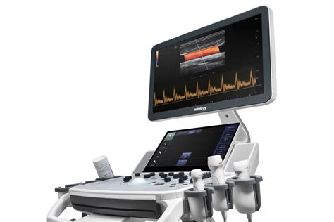 Mindray Dc40 Ultrasound Equipment At Ultra Select Medical