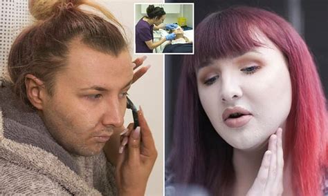 Miss Transgender Uk Reveals She Can Smell Her Facial Hair Being Burnt Off In The Bad Skin Clinic