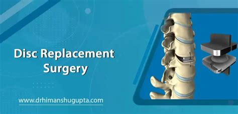 Disc Replacement Surgery In Jaipur Dr Himanshu Gupta
