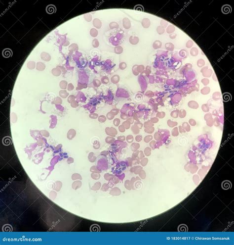 Phagocytosis White Blood Cells