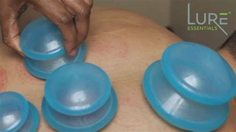 Cupping Therapy Set Edge By Lure Essentials Benefits Of Cupping And