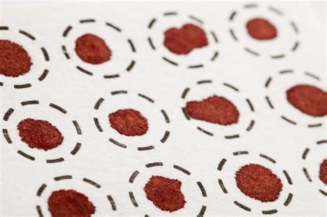 Dried Blood Spot Samples Can Reliably Detect Hepatitis B Antibodies In