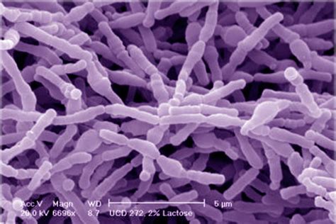 Bifidobacterias Aliadas Contra El C Ncer Biotechmagazineandnews Com