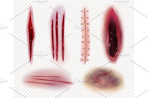 Realistic Scars Medical Surgical Pre Designed Vector Graphics