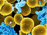 The affected area might be: Study: MRSA Emerged Long Before Introduction of Antibiotic ...