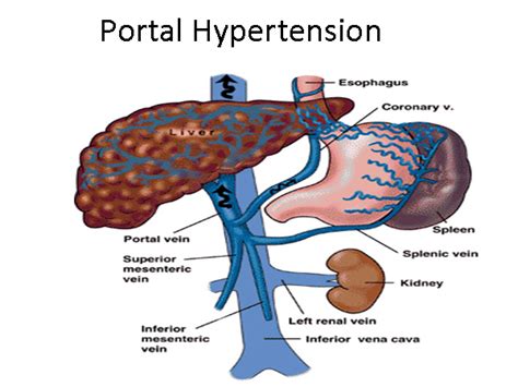 Central region of liver which contains the hepatic artery, portal vein, lymphatic vessels, and extrahepatic bile ducts (referred to as portal area). Liver & Portal Hypertension | Gastro Surgery Group