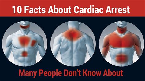 Cardiac Arrest Facts To Know About Sudden Cardiac Arrest That Could Save If Someone Is
