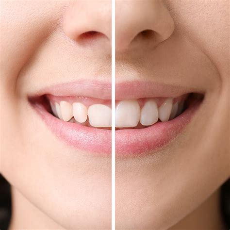 Cosmetic Dentistry Warsaw In Cosmetic Dentist Dental Solutions