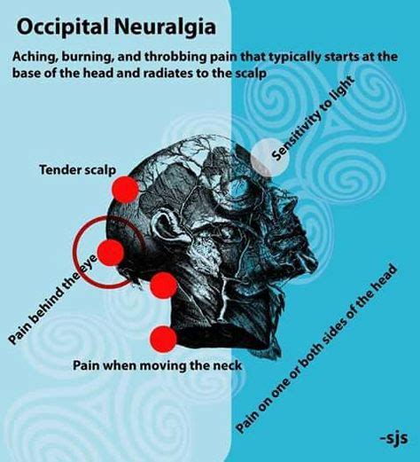 96 Occipital Neuralgia Ideas Occipital Neuralgia Neuralgia Occipital