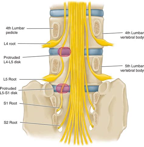 Back And Neck Pain Clinical Manifestations Of Neurologic Disease
