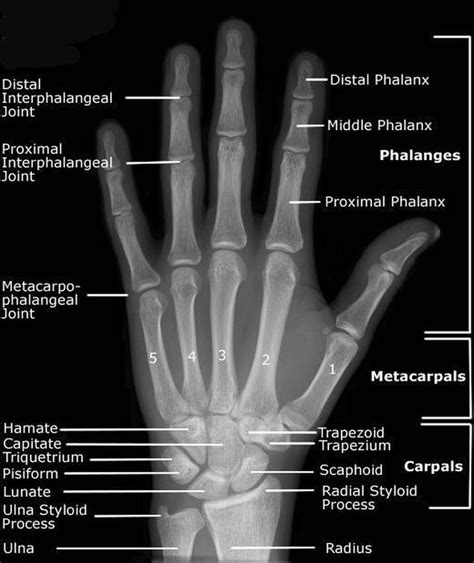X Ray Wrist And Hand Medizzy