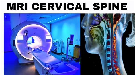 How To Do Mri Cervical Spine Planning Mri Cx Spine Scan Youtube