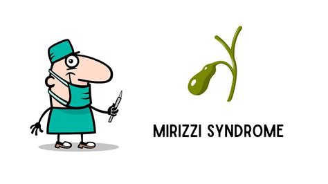 Mirizzi Syndrome YouTube