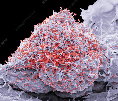 Hiv Infected Cell Sem Stock Image C0382192 Science Photo Library