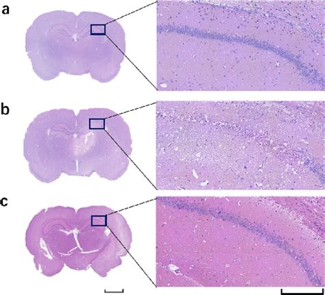 Representative Images Of The Brain Morphology Revealed By Hande Staining