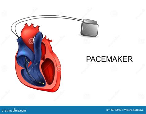Corazón Y Marcapasos Cardiología Ilustración Del Vector Ilustración