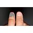 What Your Fingernail Lines Say About Health