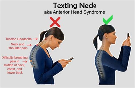 Text Neck Syndrome Il Dolore Cervicale Causato Dallo Smartphone