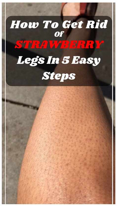 Five Easy Steps To Get Rid Of Strawberry Legs Quickly Boocado