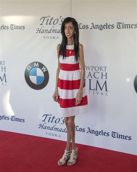 Lizzie Velasquez On The Nbff Red Carpet
