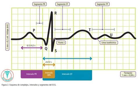 Medicina General Universal Que Es Un Electrocardiograma Hot Sex Picture