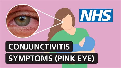 Conjunctivitis Symptoms And Treatment For Red Itchy Watery Eyes
